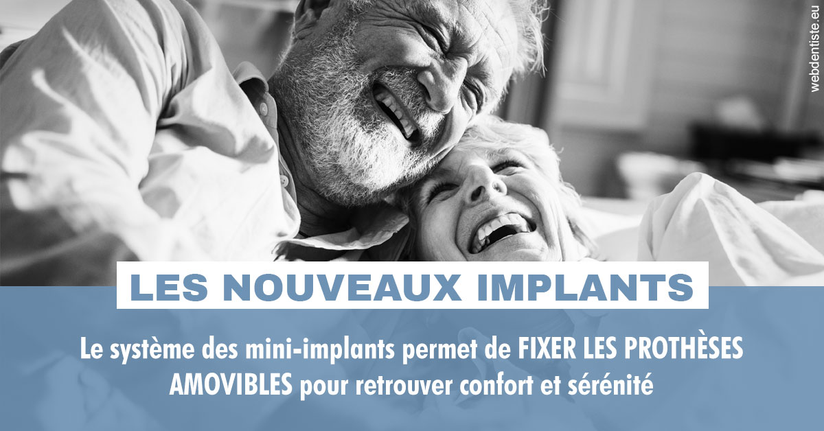 https://www.drs-bourhis-et-lawniczak-orthodontistes.fr/Les nouveaux implants 2