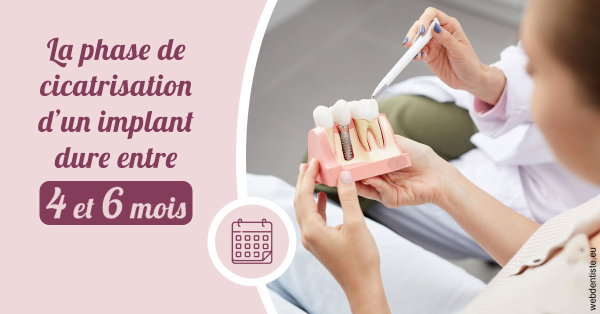 https://www.drs-bourhis-et-lawniczak-orthodontistes.fr/Cicatrisation implant 2