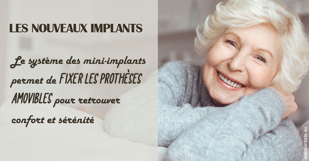https://www.drs-bourhis-et-lawniczak-orthodontistes.fr/Les nouveaux implants 1