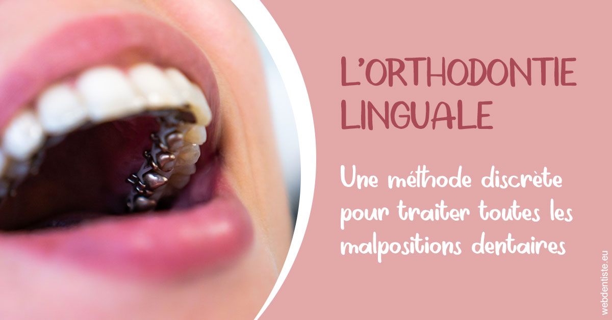https://www.drs-bourhis-et-lawniczak-orthodontistes.fr/L'orthodontie linguale 2