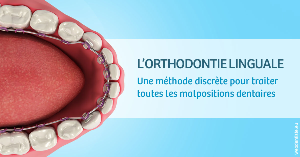 https://www.drs-bourhis-et-lawniczak-orthodontistes.fr/L'orthodontie linguale 1