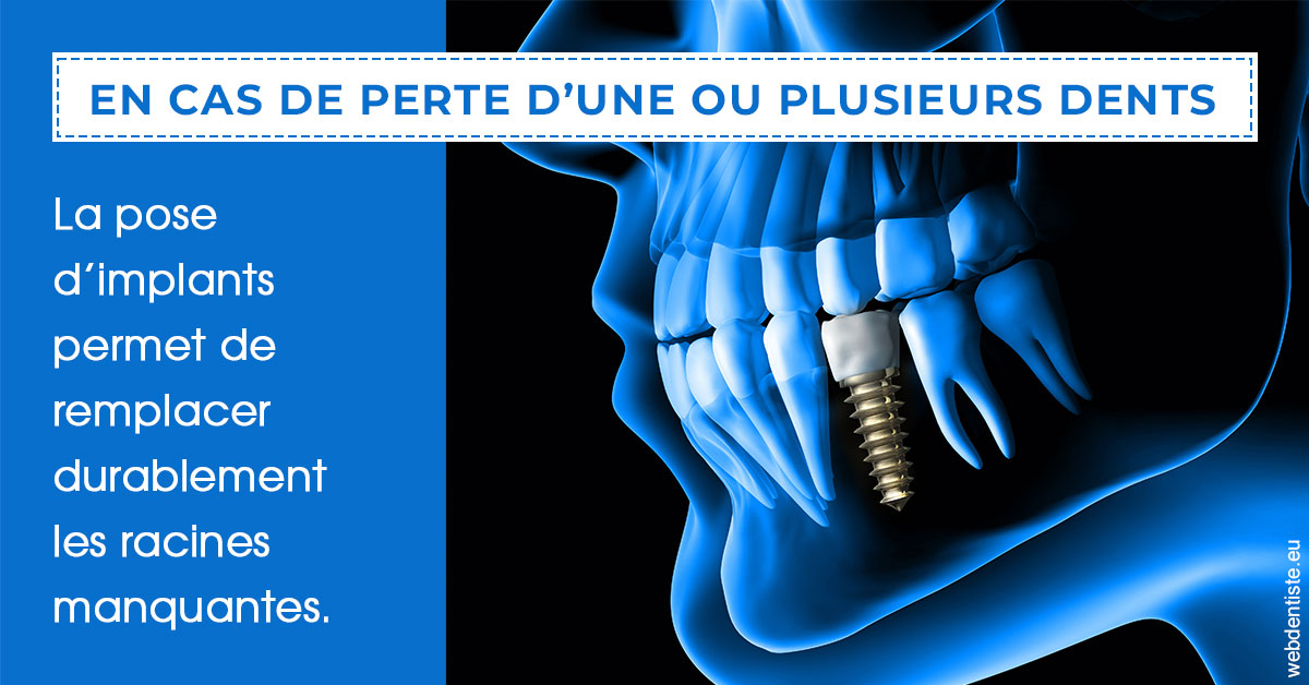 https://www.drs-bourhis-et-lawniczak-orthodontistes.fr/2024 T1 - Implants 01