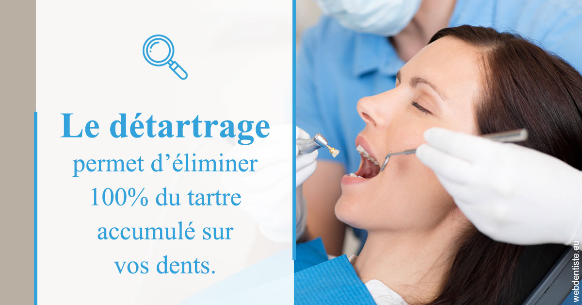 https://www.drs-bourhis-et-lawniczak-orthodontistes.fr/En quoi consiste le détartrage