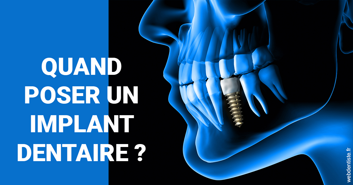 https://www.drs-bourhis-et-lawniczak-orthodontistes.fr/Les implants 1