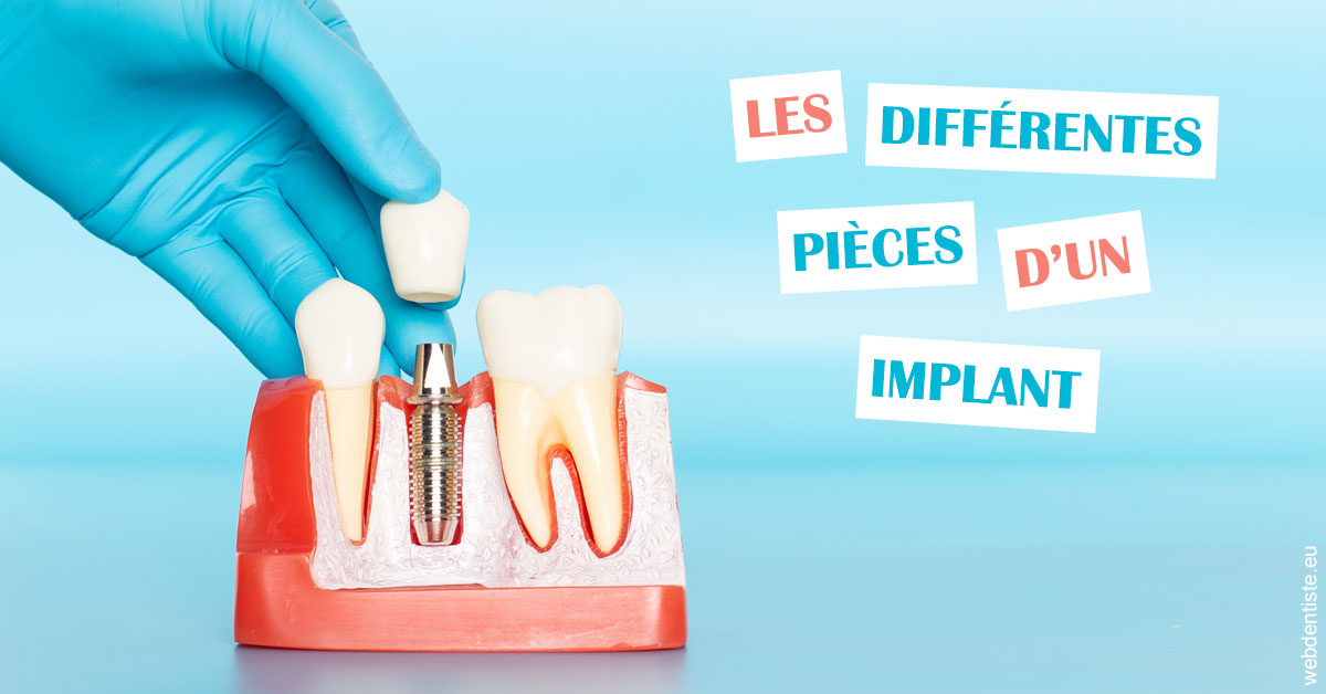 https://www.drs-bourhis-et-lawniczak-orthodontistes.fr/Les différentes pièces d’un implant 2