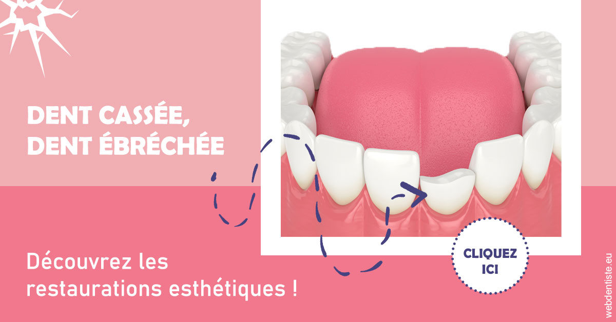 https://www.drs-bourhis-et-lawniczak-orthodontistes.fr/Dent cassée ébréchée 1