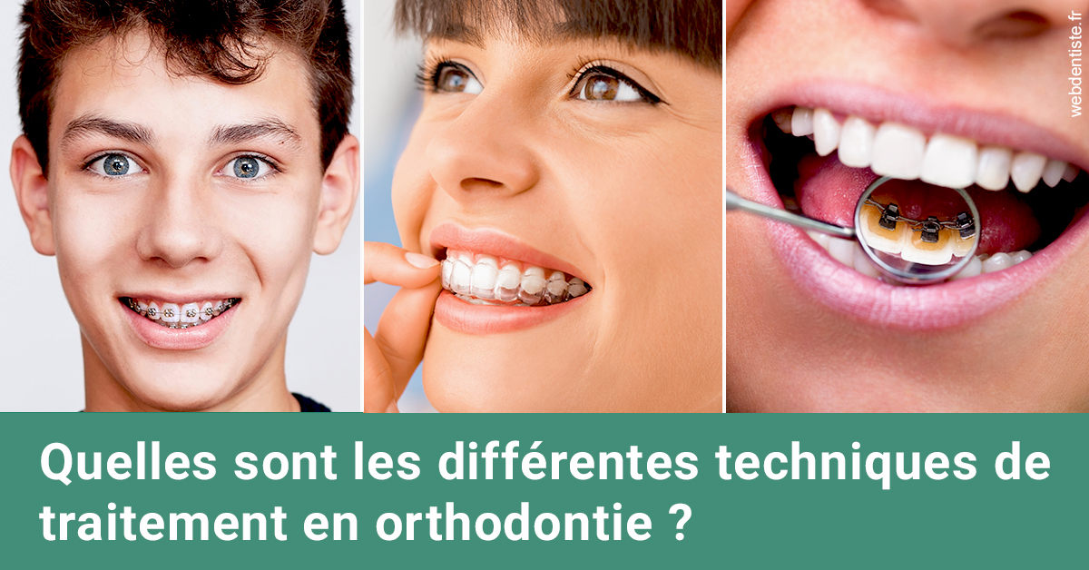 https://www.drs-bourhis-et-lawniczak-orthodontistes.fr/Les différentes techniques de traitement 2