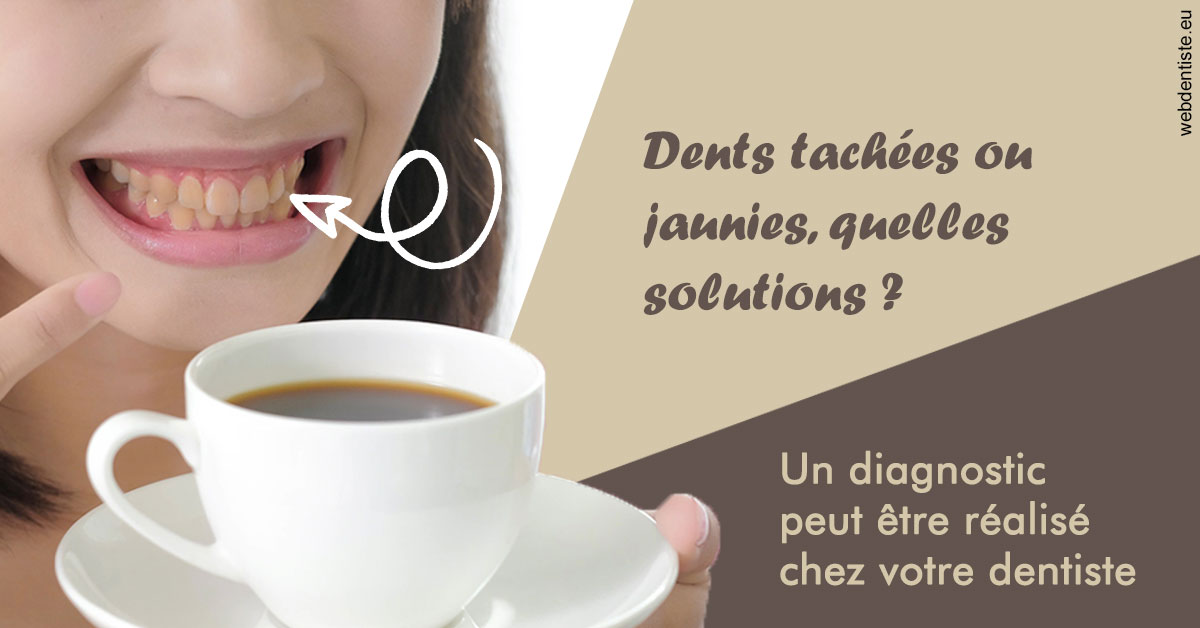 https://www.drs-bourhis-et-lawniczak-orthodontistes.fr/Dents tachées 1