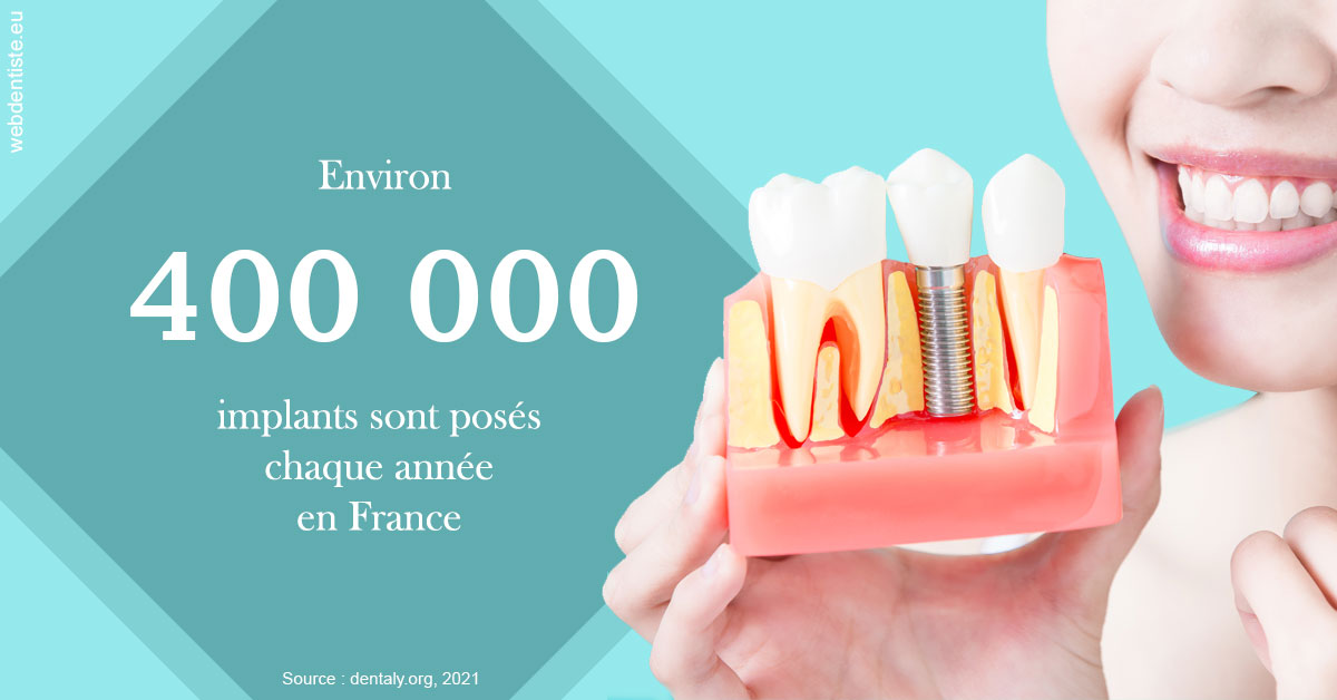 https://www.drs-bourhis-et-lawniczak-orthodontistes.fr/Pose d'implants en France 2