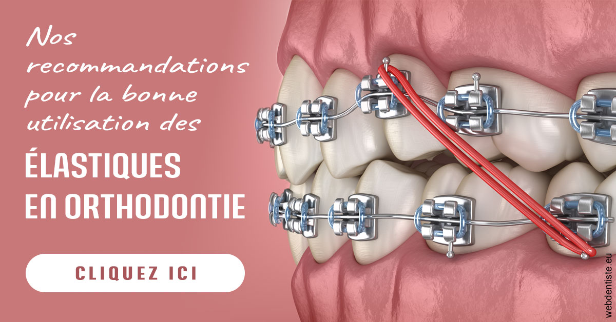 https://www.drs-bourhis-et-lawniczak-orthodontistes.fr/Elastiques orthodontie 2