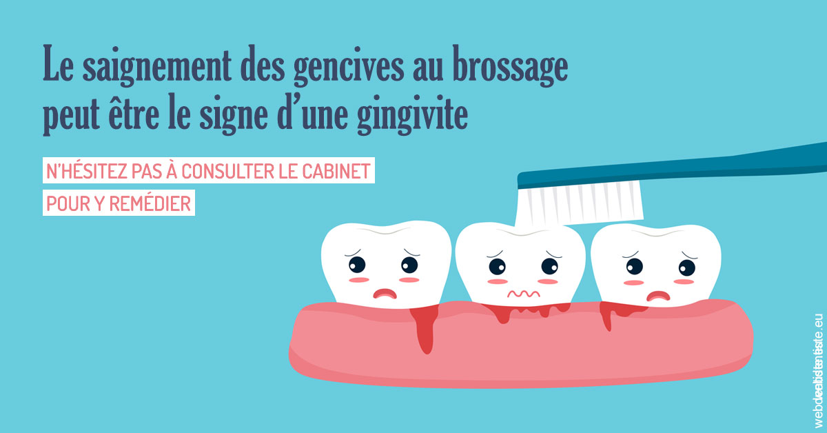 https://www.drs-bourhis-et-lawniczak-orthodontistes.fr/2023 T4 - Saignement des gencives 02